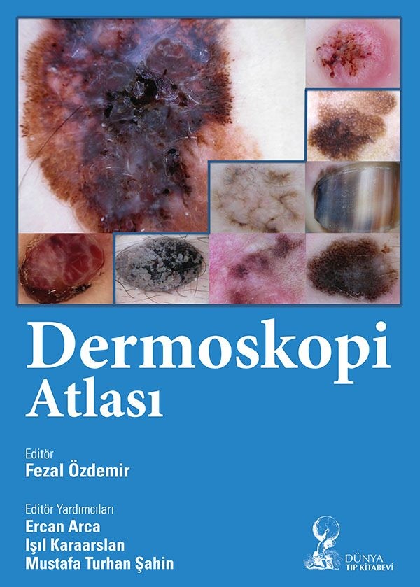 Dermoskopi Atlası/Özdemir