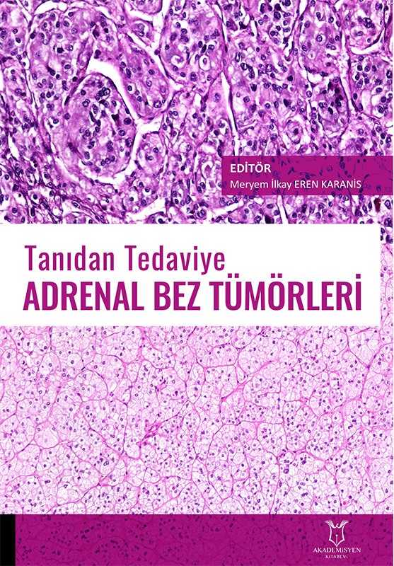 Tanıdan Tedaviye Adrenal Bez Tümörleri