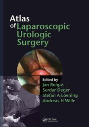 Atlas of Laparoscopic Urologic Surgery