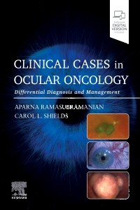 Clinical Cases in Ocular Oncology Differential Diagnosis and Management