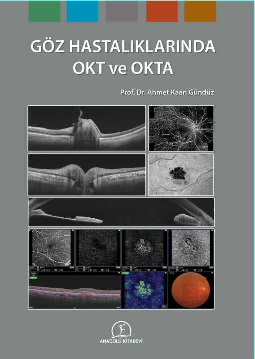 Göz Hastalıklarında OKT ve OKTA