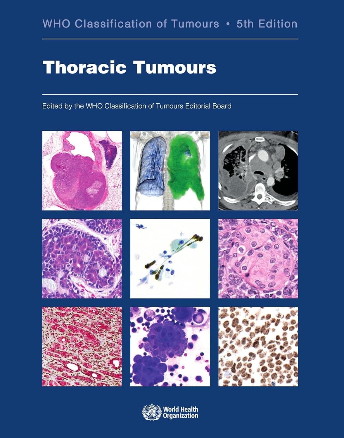 Thoracic Tumours WHO Classification of Tumours, 5th