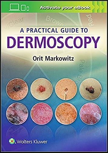 A Practical Guide to Dermoscopy