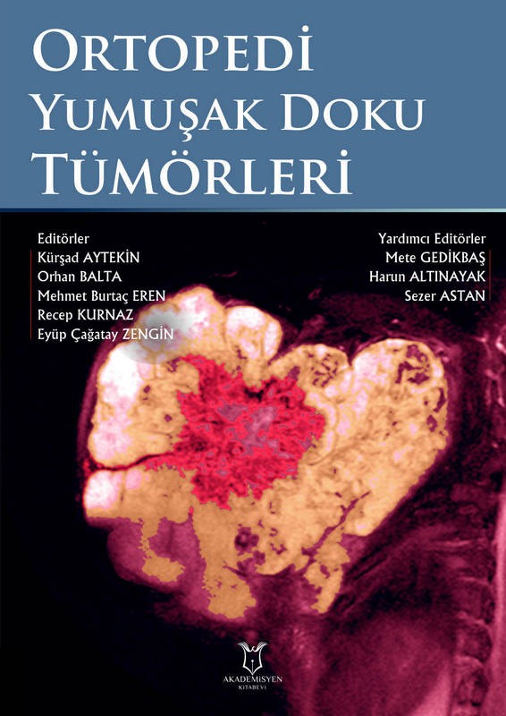 Ortopedi Yumuşak Doku Tümörleri