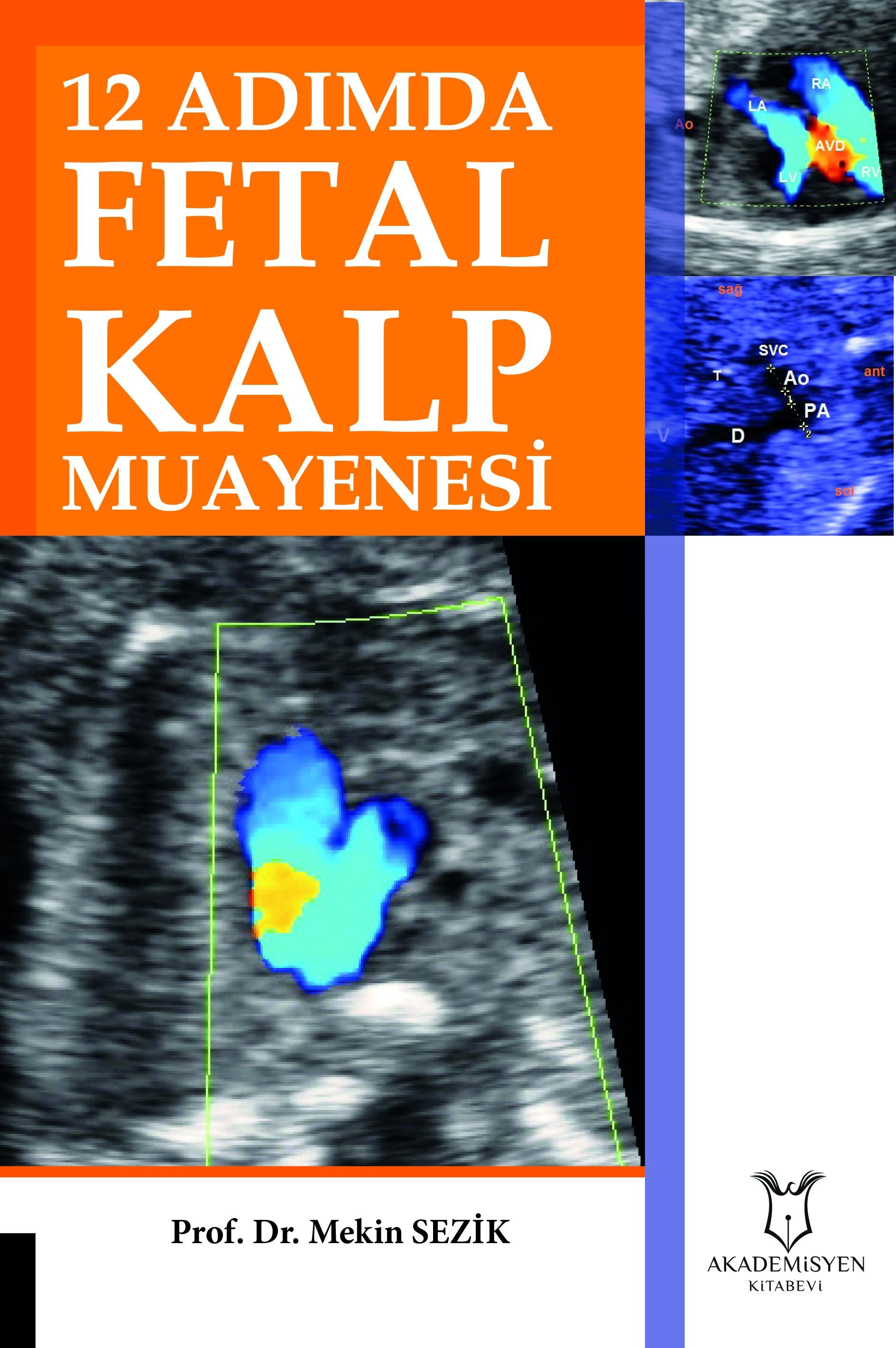 12 Adımda Fetal Kalp Muayenesi