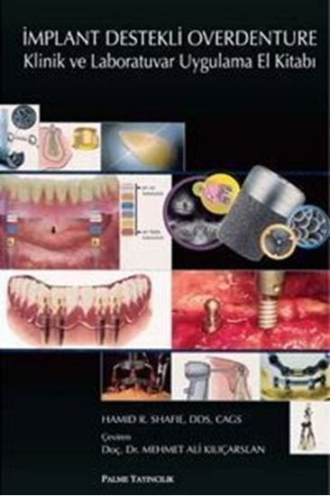 İmplant Destekli Overdenture Klinik ve Laboratuvar Uygulama El Kitabı