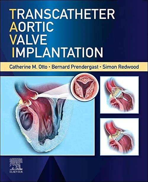 Transcatheter Aortic Valve Implantation