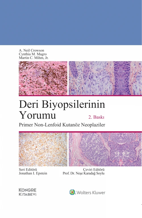 Deri Biyopsilerinin Yorumu Primer Non-Lenfoid Kutanöz Neoplaziler 2.BASKI