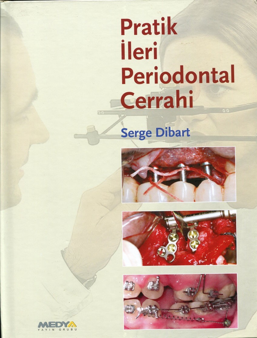 Pratik İleri Periodontal Cerrahi