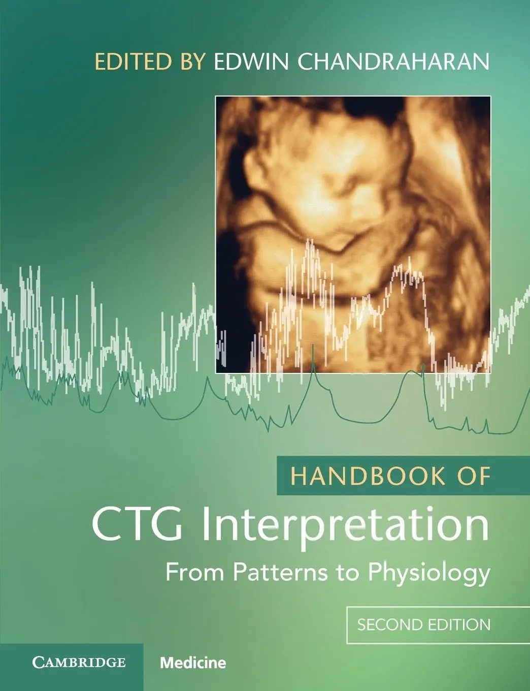 Handbook of CTG Interpretation 2nd Edition
