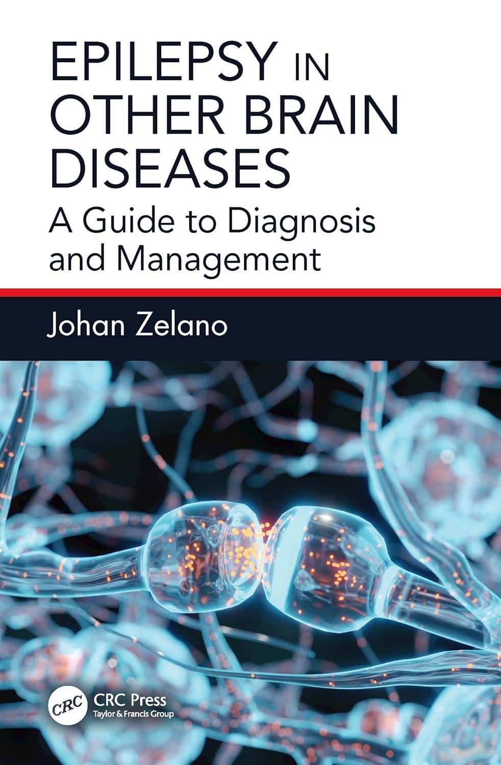 Epilepsy in Other Brain Diseases A Guide to Diagnosis and Management