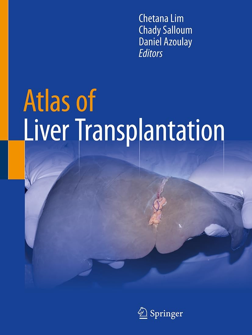 Atlas of Liver Transplantation