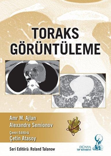 Toraks Görüntüleme