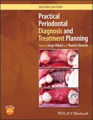 Practical Periodontal Diagnosis and Treatment Planning, 2nd Edition