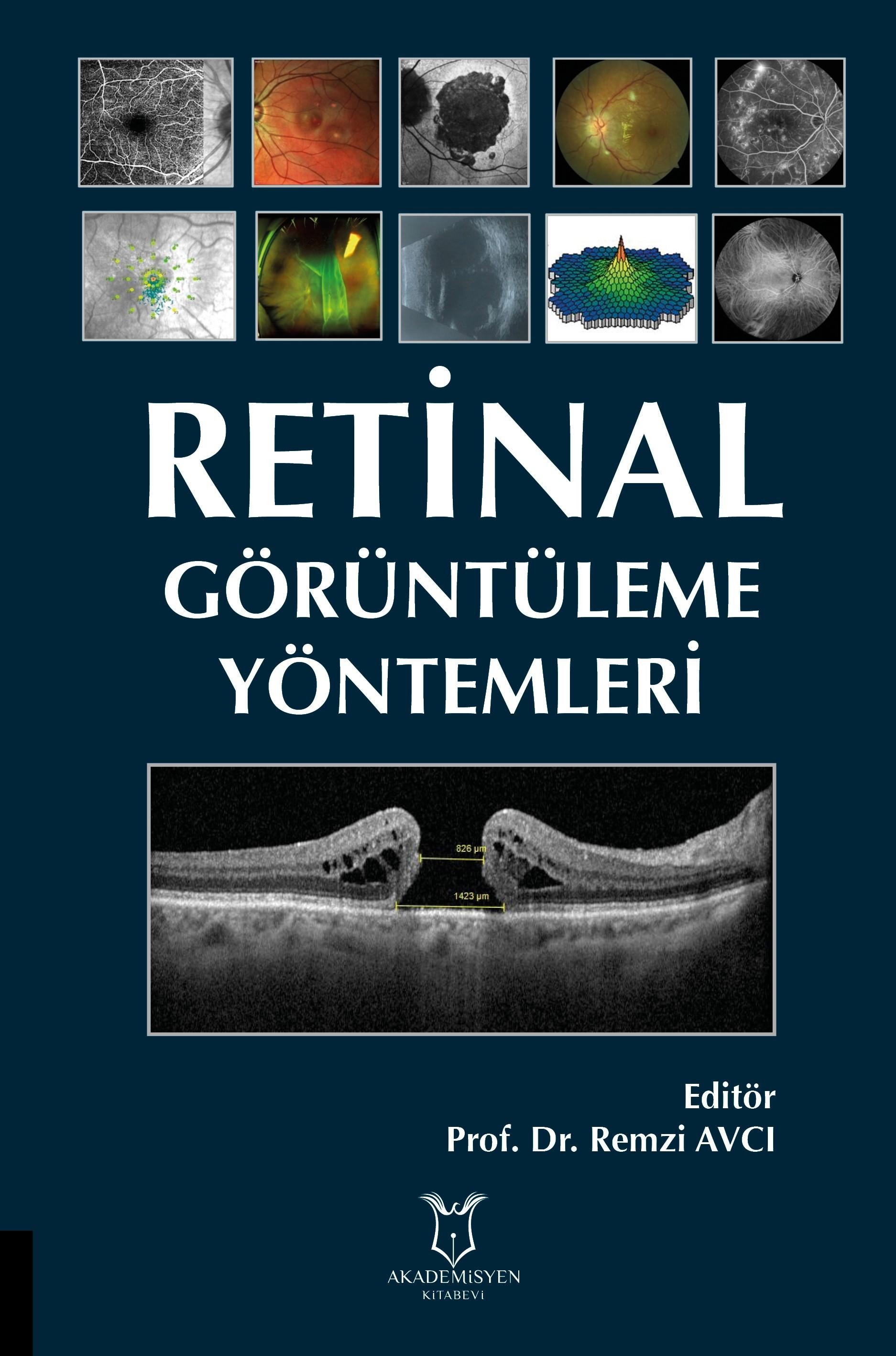 Retinal Görüntüleme Yöntemleri