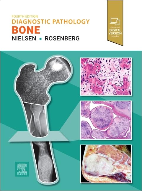 Diagnostic Pathology: Bone, 4th Edition