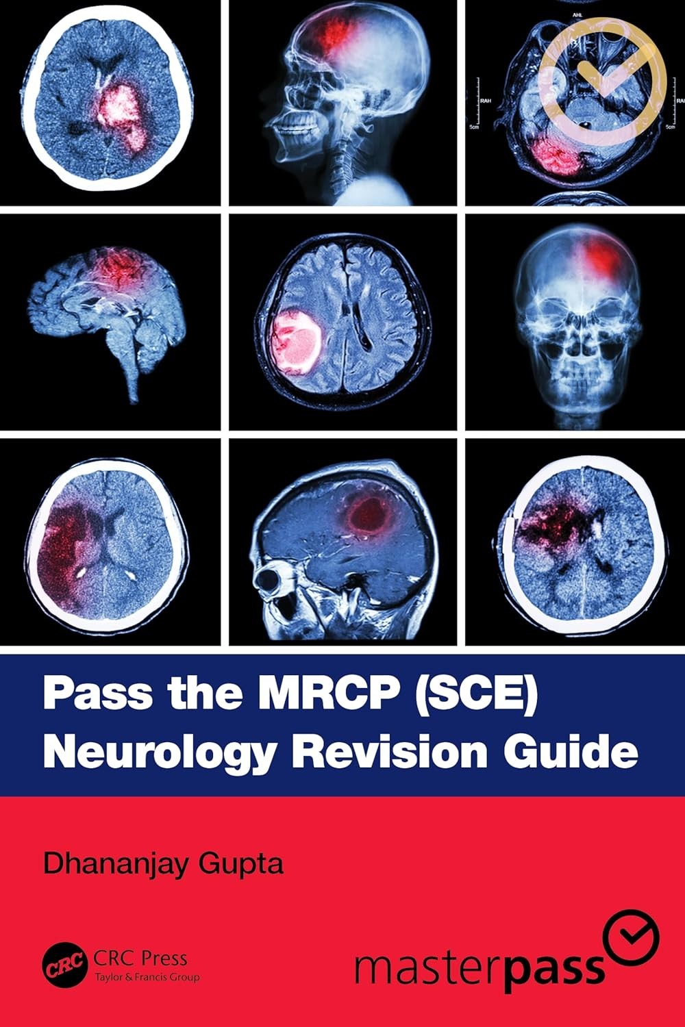 Pass the MRCP (SCE) Neurology Revision Guide