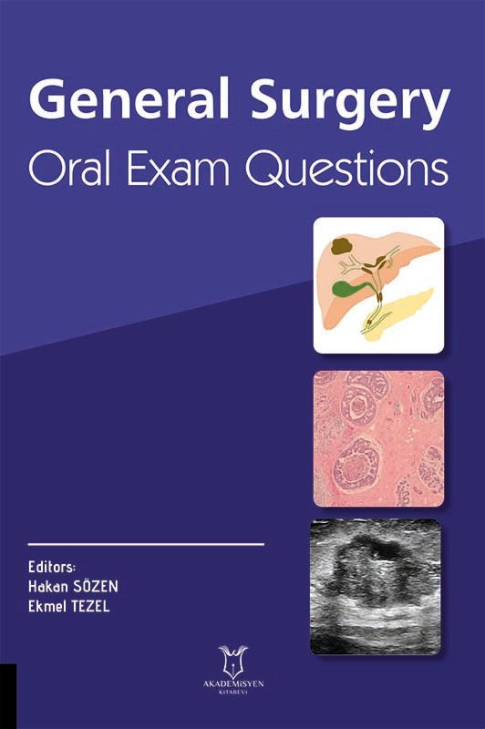 General Surgery Oral Exam Questions