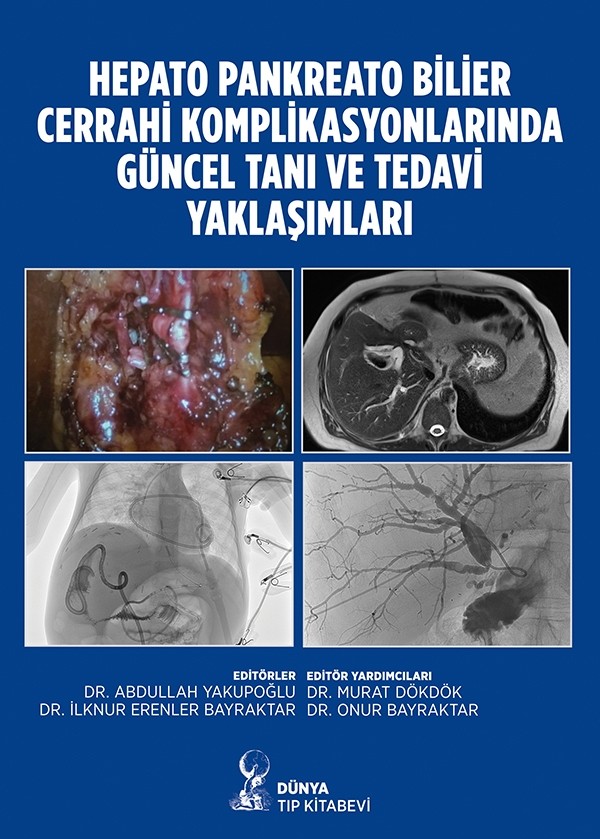 Hepato Pankreato Bilier Cerrahi Komplikasyonlarında Güncel Tanı ve Tedavi Yaklaşımları
