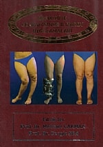 Deformite Cerrahisinde İlizarov Uygulamaları