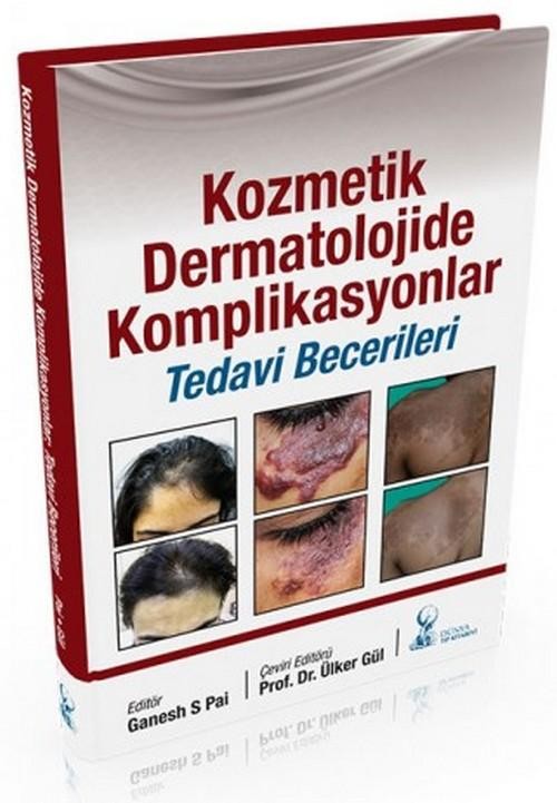 Kozmetik Dermatolojide Komplikasyonlar: Tedavi Becerileri