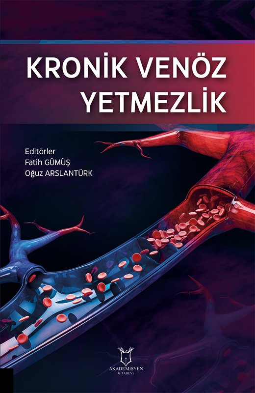 Kronik Venöz Yetmezlik