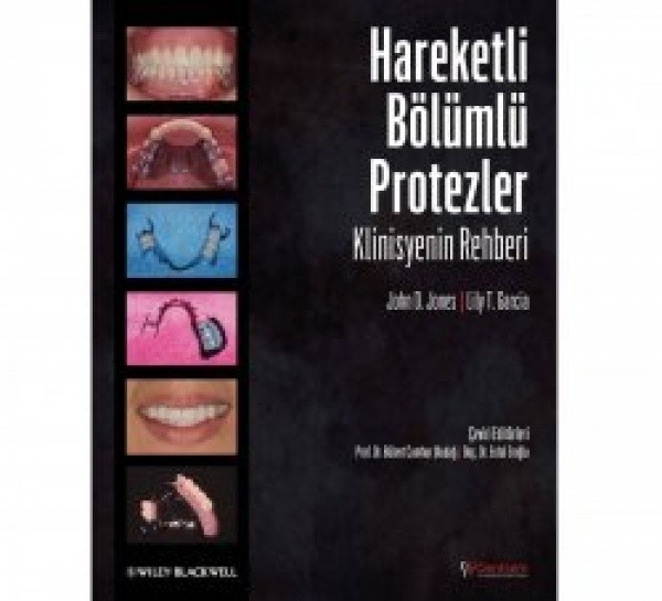 Hareketli Bölümlü Protezler