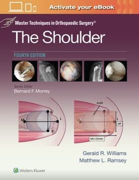 Master Techniques in Orthopaedic Surgery: The Shoulder, 4th Edition