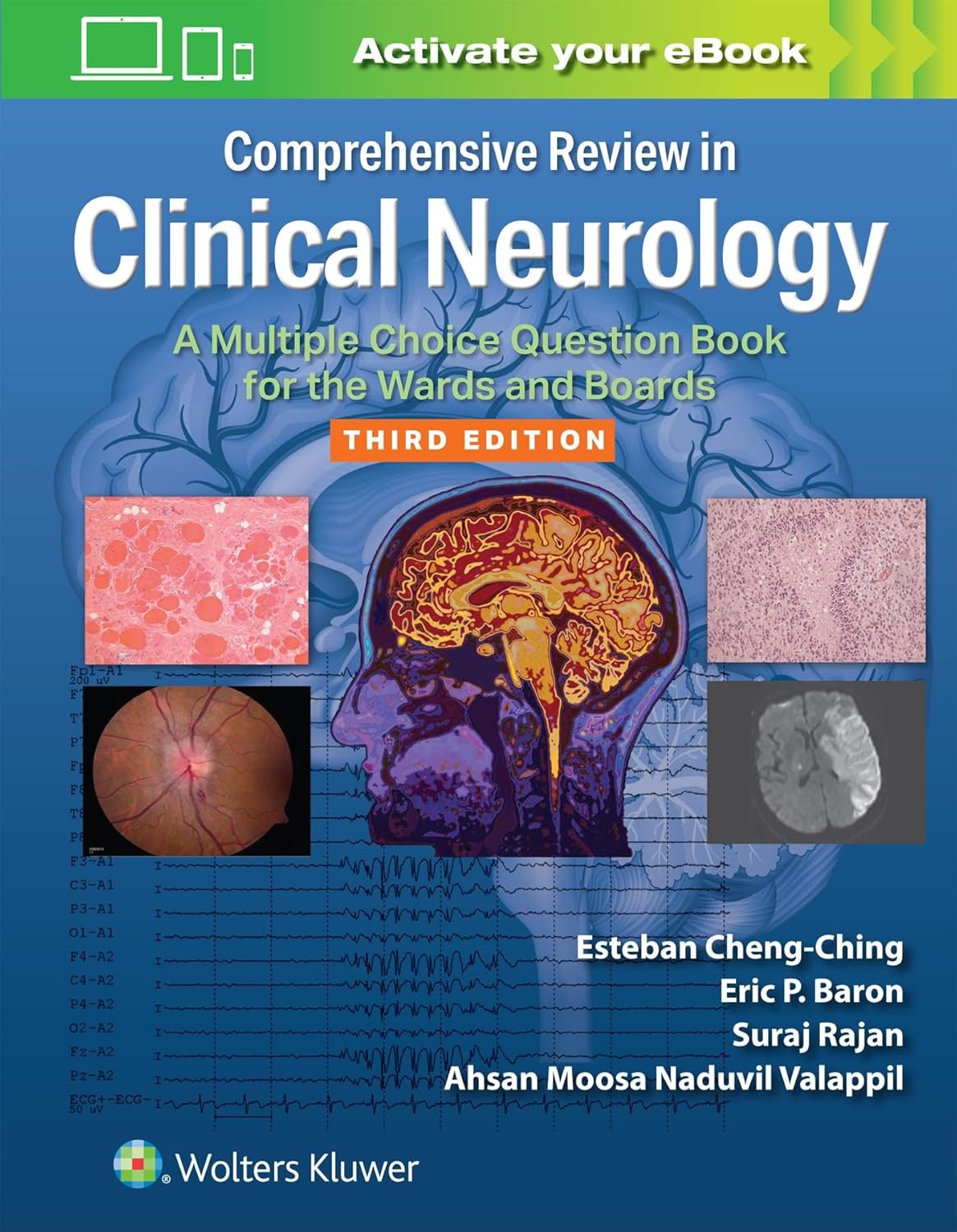 Comprehensive Review in Clinical Neurology: A Multiple Choice Question Book for the Wards and Boards
