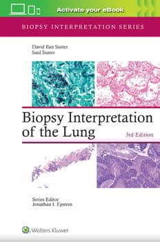 Biopsy Interpretation of the Lung Print + ebook with Multimedia,3th Edition