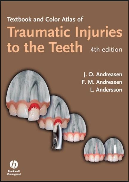 Textbook and Color Atlas of Traumatic Injuries to the Teeth