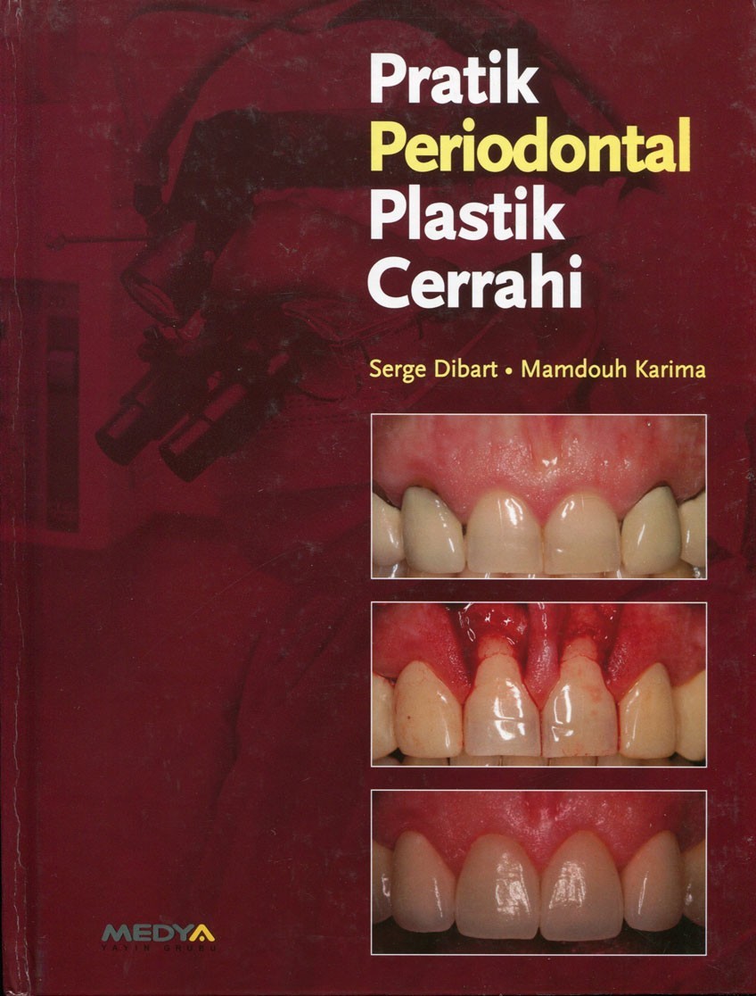 Pratik Periodontal Plastik Cerrahi