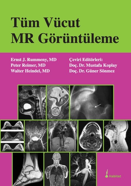 Tüm Vücut MR Görüntüleme