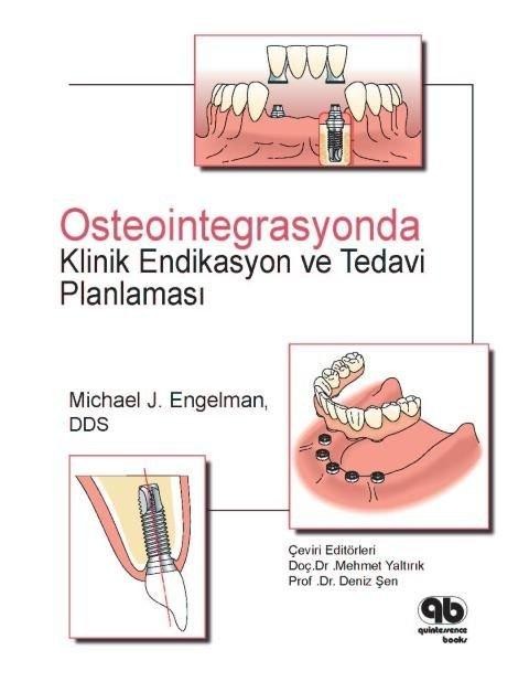 Osteointegrasyonda Klinik Endikasyon ve Planlama