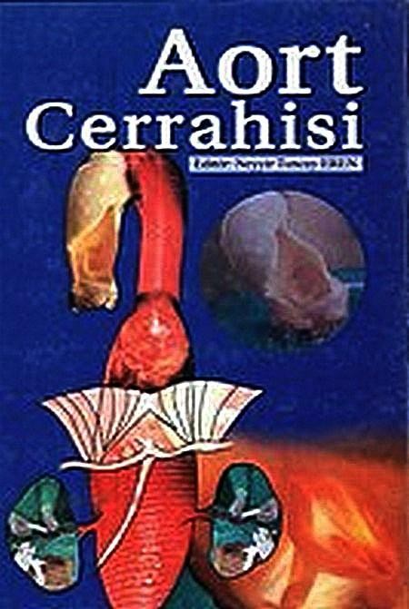 Aort cerrahisi