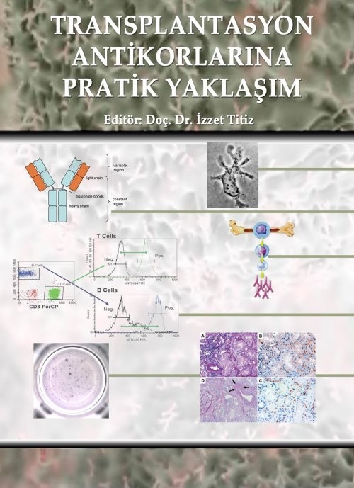 Renal Transplantasyona Pratik Yaklaşım Humoral Sorunlar
