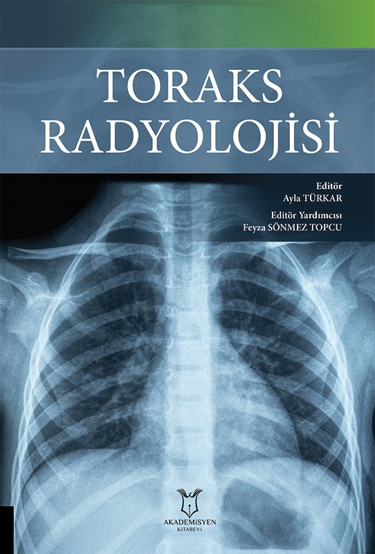 Toraks Radyolojisi