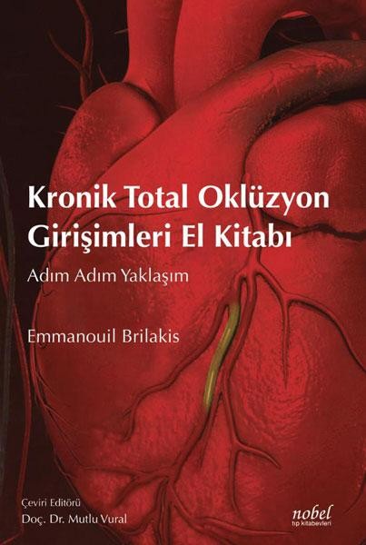 Kronik Total Oklüzyon Girişimleri El Kitabı:Adım Adım Yaklaşım