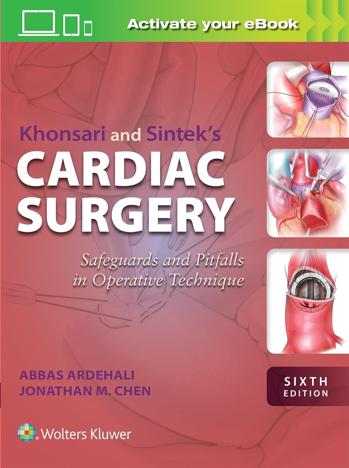 Khonsari and Sintek's Cardiac Surgery Safeguards and Pitfalls in Operative Technique,6 Edition