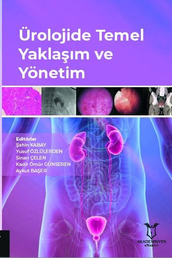 Ürolojide Temel Yaklaşım ve Yönetim