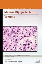 Mesane Biyopsilerinin Yorumu Biyopsi Yorumları Serisi