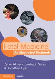 Fetal Medicine An Illustrated Textbook