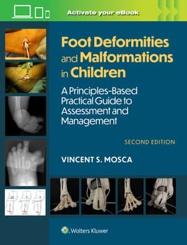 Foot Deformities and Malformations in Children: A Principles-Based, Practical Guide to Assessment and Management: Print + eBook with Multimedia, 2 Edition