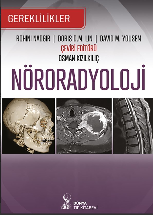 Nöroradyoloji Gereklilikler