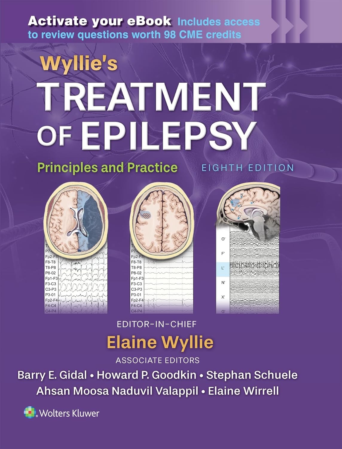 Wyllie's Treatment of Epilepsy: Print + eBook with Multimedia: Principles and Practice,8 Edition