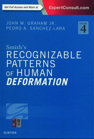 Smith`s Recognizable Patterns of Human Deformation, 4e Hardcover