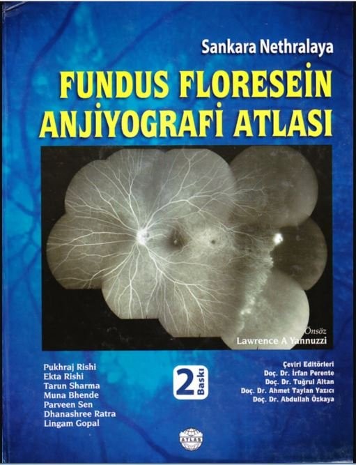 Fundus Floresein Anjiyografi Atlası