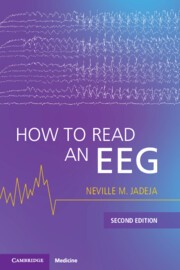 How to Read an EEG