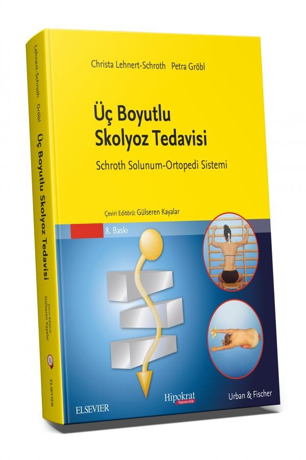 Üç Boyutlu Skolyoz Tedavisi