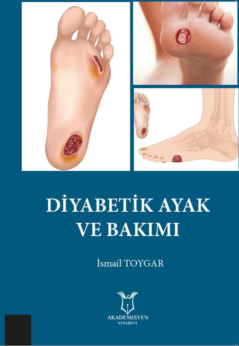 Diyabetik Ayak ve Bakımı